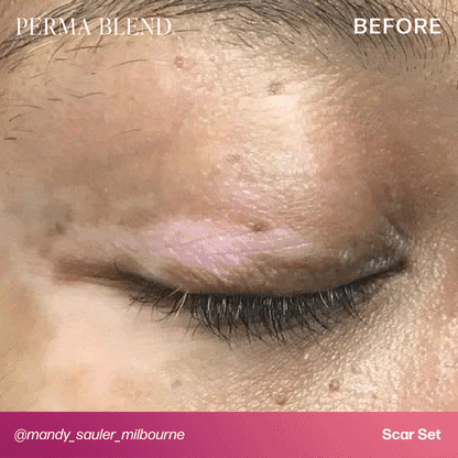 Dark Dermis - Mandy Sauler Scar